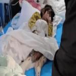 Trung Quốc: “Mẹ kế” bạo hành bé gái 4 tuổi dã man suýt phải cắt bỏ hai chân